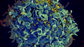 UN says if US funding for HIV programs is not replaced, millions more will die by 2029
